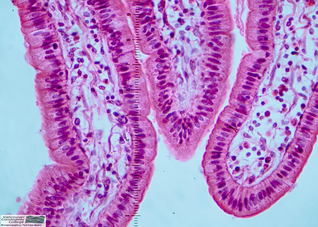 small_intestine__columnar_epithelium___hpo_mag_by_spyrogenes d5if897